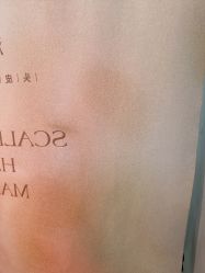 -润复丝·泽发防脱头皮管理