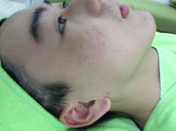 -苗医生草本科技祛痘