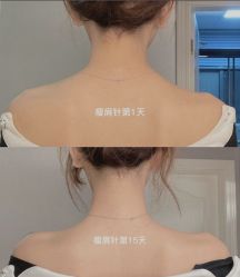 -上海漾颜医疗美容