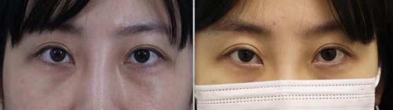 -丰联丽格医疗美容·联合丽格眼整形中心