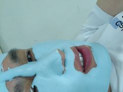 体验后-悟空祛痘·诺奖技术专业店