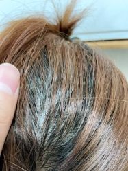 -熙朵美学植发·连锁品牌