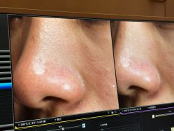 -苑苑vbeauty科技美容SPA