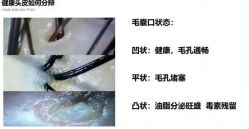 -诗碧曼养发