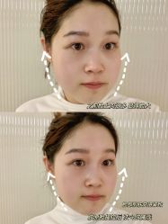 -HYOUNG 禾漾·BTL官方美学中心