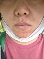 体验后-四川米兰柏羽医学美容医院