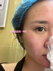 点击看大图 体验后-南京康美美容医院·旗舰店
