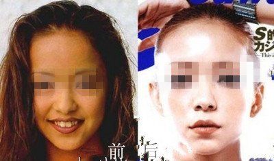 -CMS西美斯·美式医疗美容