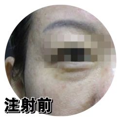 -天津时光诺颜·轻医美·轮廓抗衰中心