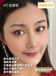 -北京米扬丽格医疗美容·联合丽格鼻整形中心