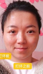 -上海玫瑰医疗美容医院