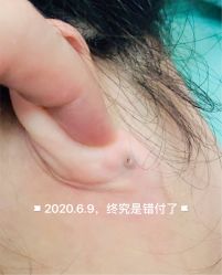 -花师傅专业手穿耳洞打耳洞穿孔