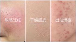 -MLP美丽派·问题肌疗愈中心