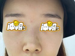 体验前-重庆联合丽格第五医疗美容医院