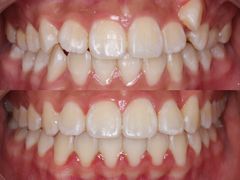 -精德口腔·种植修复·儿牙中心(财富中心店)