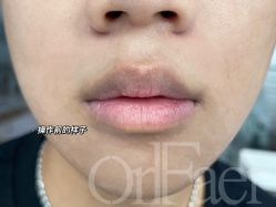 点击看大图 -OnFaer.纹眉半永久无创洗眉