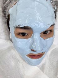 体验后-悟空祛痘·诺奖技术专业店