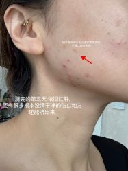 体验后-演员的秘密·皮肤管理