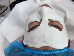 体验后-悟空祛痘·诺奖技术专业店