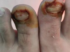 -新甲连锁灰指甲·甲沟炎·鸡眼(黑龙江路店)