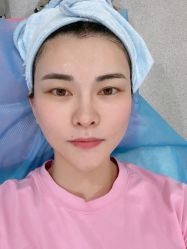 体验后-SKINIST丽铂医疗美容