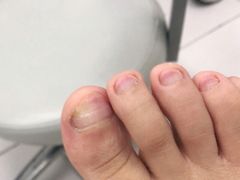 -新甲连锁灰指甲·甲沟炎·鸡眼(黑龙江路店)