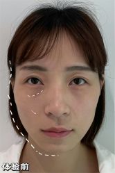 -Yestar重庆艺星医疗美容医院