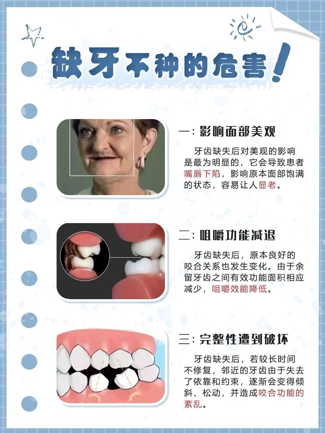 种植牙必看,缺牙不重要的危害