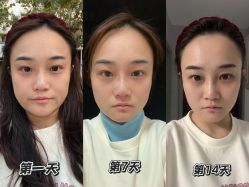-上海伊莱美医疗美容医院