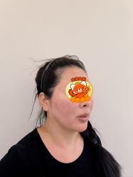 -海涛医疗美容·面部抗衰·注射美鼻