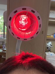 点击看大图 -大麦微针植发丨全国连锁