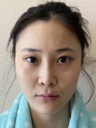 -北京米扬丽格医疗美容·联合丽格鼻整形中心