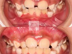 -Dr.Z dental仁康种植矫正中心