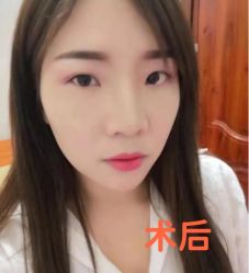 -天津健丽·去眼袋医疗美容机构
