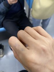 -一次性洗纹身·修复疤痕·超皮秒