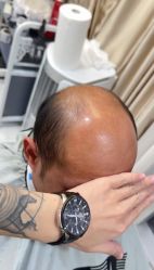 -发饰美男士增发补发假发定制店