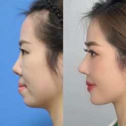 -上海伊莱美医疗美容医院