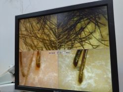 -章光101防脱养发荟