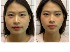 -修申骨雕小颜脊柱骨盆管理产后修复