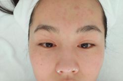 -乐活概念专业皮肤管理连锁