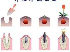 -团圆口腔·种植中心(锦江院区)