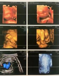 -杭州医学院附属妇儿医院