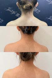 -郡艺医疗美容·微整·眼鼻吸脂