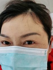 -莲姿娜半永久纹眉皮肤管理