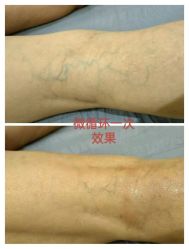-香薇妮丝·定制减肥·身材管理