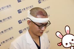 点击看大图 -大麦微针植发丨全国连锁