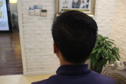 点击看大图 -大麦微针植发丨全国连锁