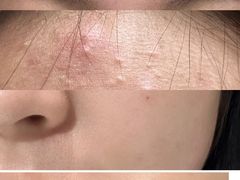 -上置·美兰优湖