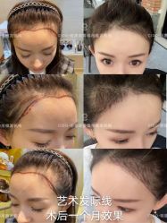 -熙朵美学植发连锁