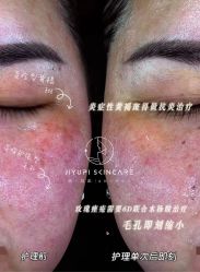 点击看大图 -MLP美丽派·问题肌疗愈中心